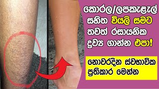 Dry skin treatment at home sinhala  How to maintain a dry skin [upl. by Aynnat]