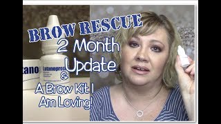 ✅BROW RESCUE2 Month UpdateGrow Eyebrows Fast wLatisseCareprostLatanoprostOver 40 Beauty [upl. by Lamaj]