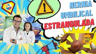 LAS HERNIAS Causas signos y síntomas diagnóstico y tratamiento [upl. by Jahdal521]