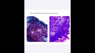 Pathology Introduction 1A [upl. by Melodie]