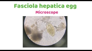 Fasciola hepatica [upl. by Martijn]