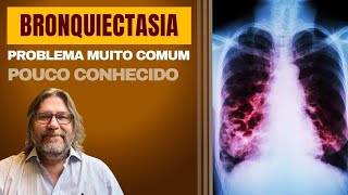 Bronquiectasias problema pulmonar desconhecido mas muito comum [upl. by Saudra941]