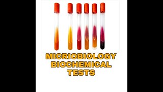 Biochemical Tests for Bacterial IdentificationTSIUrease Citratemicrobiology Biochemical tests [upl. by Airal]