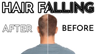 The BEST Solution of Hair Fall and its Regrowth  Homeopathic Treatment  By Dr Ataullah [upl. by Bernardi374]