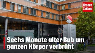 Sechs Monate alter Bub am ganzen Körper verbrüht  kronetv NEWS [upl. by Rondi]