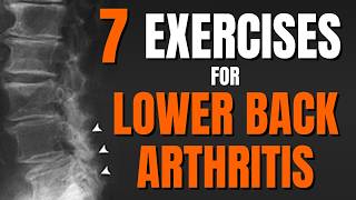 Top 7 Exercises to Ease Spondylosis amp Back Arthritis Pain Ages 60 [upl. by Aihcropal]