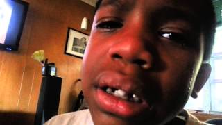 Crying Five Year Olds Super Loose Tooth [upl. by Cj]