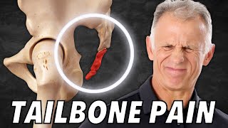 Top 5 SelfTreatments for Tailbone Coccyx Pain or Coccydynia [upl. by Intyre874]