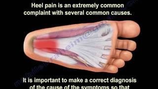 Heel Pain and plantar fascitis  Everything You Need To Know  Dr Nabil Ebraheim [upl. by Ermengarde]