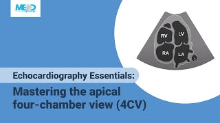 Echocardiography Essentials Mastering the apical fourchamber view 4CV [upl. by Ikkiv289]