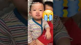 Croup Difficulty breathing Barking cough [upl. by Jangro]