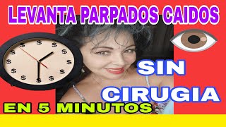 COMO LEVANTAR LOS PARPADOS CAIDOS EN 5 MINUTOS SIN CIRUGIA [upl. by Euqor]