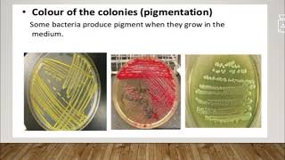 Cultural characteristics amp Colony morphology of Bacterial colony [upl. by Demitria]