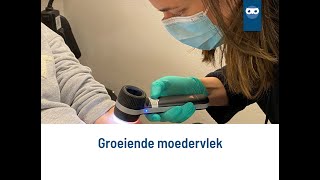 groeiende moedervlek [upl. by Jurgen]