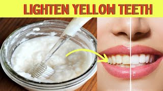 How to whiten your teeth at home in 1 day with baking soda [upl. by Onihc]