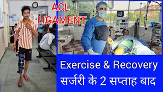 ACL LIGAMENT FRACTURE EXERCISE AND RECOVERY AFTER 2 Weeks aclligament [upl. by Dlanigger]