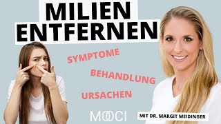 Milien  Wie kann man sie entfernen [upl. by Marj]