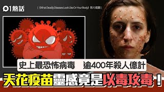 Know more SmallpoxVariola Virus了解更多天花病毒 廣東話版本 [upl. by Lerrehs]