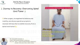 🚶‍♂️ Journey to Recovery Overcoming Spinal Cord Tumor 🚶‍♂️ [upl. by Illyes]