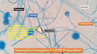 Aspergillus fumigatus growth on SDA and its LPCB Preparation showing conidia conidiophores phialid [upl. by Abbot]