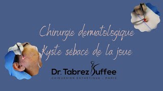 Chirurgie dermatologique [upl. by Belford]