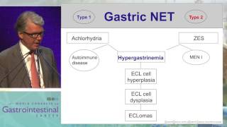 Tandem Talk 2 The approach for gastric NETs  The clinicians contribution [upl. by Atilrahc]