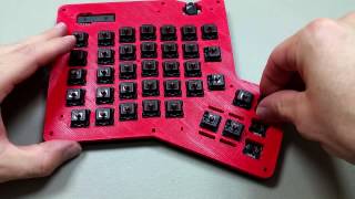 How to Build an Ergodox Assembly 9 [upl. by Bernardine688]