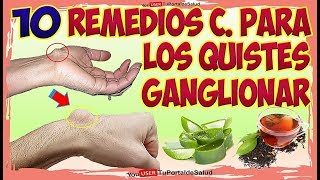 10 Remedios Caseros para Quistes Ganglionar  Como Aliviar Quistes Ganglio [upl. by Nnahtur]