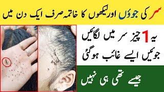 Anti Lice Treatment At Home  Juain Khatam Karne Ka Tarika  Jowon Ka Khatma [upl. by Amalle]