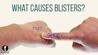 What Causes Blisters On Feet [upl. by Miranda889]