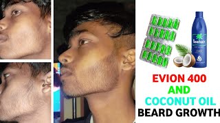 Evion 400 for beard growthevion 400 and coconut oil for beard growthhow to use evion 400 for beard [upl. by Hteb359]