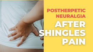 Post herpetic NeuralgiaTerrible Pain After Shingles [upl. by Kirkwood942]