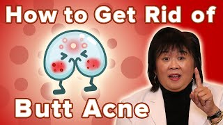 How To Get Rid Of Butt Acne [upl. by Juieta997]