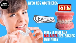 Gouttière dentaire pour alignement des dentsjoli sourire avec GetBeZen [upl. by Nosmirc]