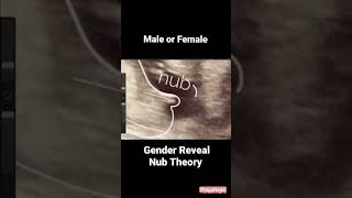 Guess the gender with nub theorybaby boy pregnancycare pregnancy ultrasound [upl. by Anecuza838]