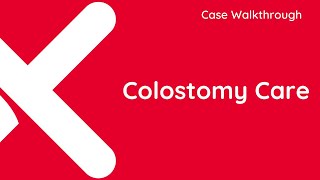 Colostomy Care [upl. by Jess]