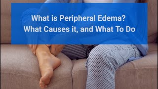 Peripheral Edema  Causes Symptoms and Treatments [upl. by Dazraf]