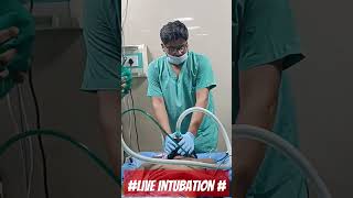 LiveTreatment Intubation [upl. by Tnecillim725]