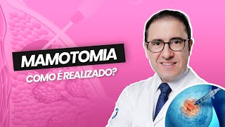 Mamotomia  O que é e Como Funciona [upl. by Ahsenev]