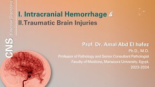 Intracranial hemorrhage and traumatic brain injury  شرح محاضرة [upl. by Quigley]