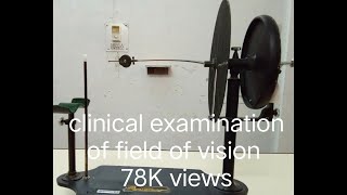 Field of Vision  Cranial Nerve II Examination  Perimetry [upl. by Amlez]