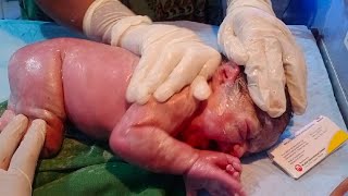 New born baby passed meconium during birth meconium mixed with vernix clean it with baby oil🥰🥰 [upl. by Brennan]