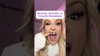 Veneers vs crowns veneers [upl. by Lemuel]