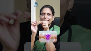 Menstrual Cup ഉപയോഗിക്കുമ്പോൾ അറിയേണ്ട കാര്യങ്ങൾ  Menstrual Cup Tips in Malayalam [upl. by Odlo]