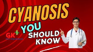 Cyanosis Kya Hai What is Cyanosis sapnajoshi5147 [upl. by Notsuh]