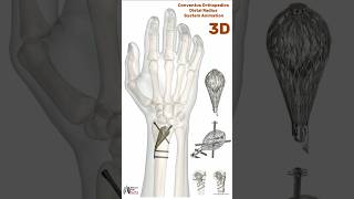 Conventus Orthopedics Distal Radius System Animation medical animation 3d short [upl. by Euqinna910]