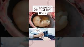 BOY ULTRASOUND PREGNANCY INFERTILITY PREGNANT PREGNANCY BABY pregnancytips shorts ttc labor [upl. by Okoy]