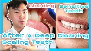 What To Do After A Deep Cleaning Scaling Teeth Root Planing [upl. by O'Rourke]