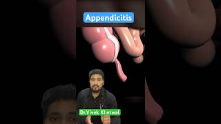 Appendicitis l Dr Vivek Khetwal shorts youtubeshorts surgeon [upl. by Greff]