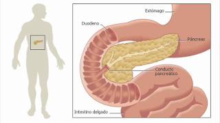 Diabetes se cura fácil 584127862954 [upl. by Dacie]